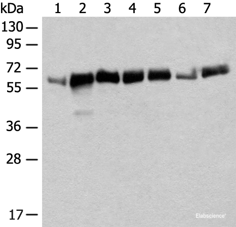 Western blot analysis of Mouse heart tissue Mouse liver tissue NIH/3T3 cell Human bladder transitional cell carcinoma grade 2-3 tissue A172 cell Human placenta tissue K562 cell lysates  using CCDC47 Polyclonal Antibody at dilution of 1:350