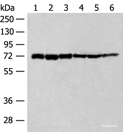 Western blot analysis of 293T cell Human fetal brain tissue Jurkat cell Hela cell Mouse heart tissue lysates  using TCF25 Polyclonal Antibody at dilution of 1:250