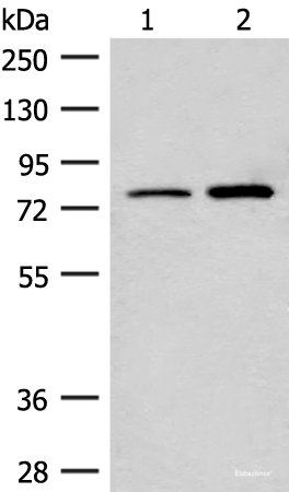 Western blot analysis of Human cerebrum tissue and Human fetal brain tissue lysates  using THOP1 Polyclonal Antibody at dilution of 1:250