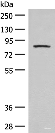 Western blot analysis of Mouse brain tissue lysate  using PFKM Polyclonal Antibody at dilution of 1:350