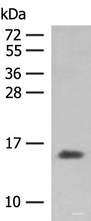 Western blot analysis of Human plasma solution  using HBG1:HBG2 Polyclonal Antibody at dilution of 1:250