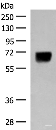 Western blot analysis of Human thyroid tissue lysate  using DGLUCY Polyclonal Antibody at dilution of 1:250