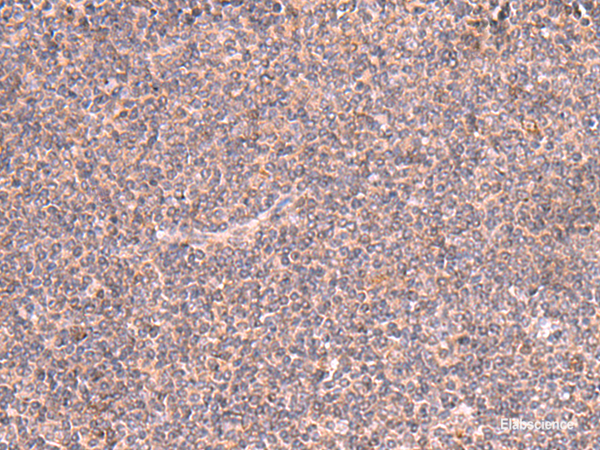 Immunohistochemistry of paraffin-embedded Human tonsil tissue  using MRPS24 Polyclonal Antibody at dilution of 1:90(×200)