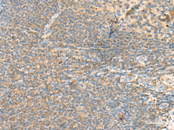 Immunohistochemistry of paraffin-embedded Human tonsil tissue  using RHOH Polyclonal Antibody at dilution of 1:90(×200)