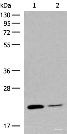 Western blot analysis of Human empty ileal tissue and Human ileum tissue lysates  using RAC3 Polyclonal Antibody at dilution of 1:400