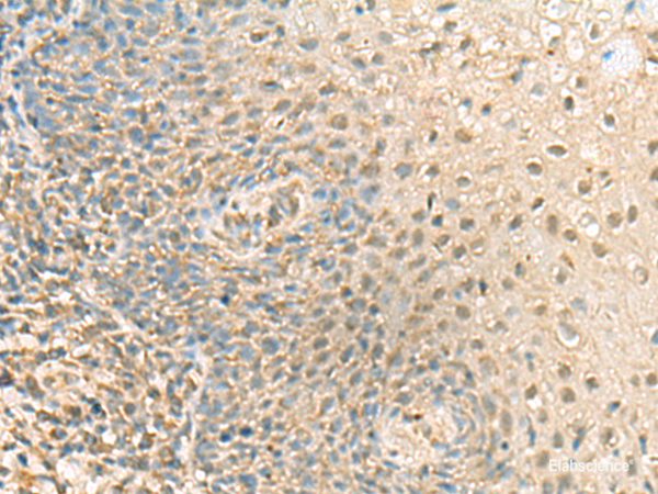 Immunohistochemistry of paraffin-embedded Human tonsil tissue  using PPCDC Polyclonal Antibody at dilution of 1:55(×200)