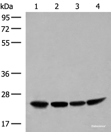 Western blot analysis of Human fetal liver tissue HepG2 K562 and Raji cell lysates  using DTYMK Polyclonal Antibody at dilution of 1:400