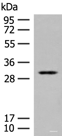 Western blot analysis of Human kidney tissue lysate  using TPMT Polyclonal Antibody at dilution of 1:400
