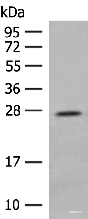 Western blot analysis of Human placenta tissue lysate  using MDFI Polyclonal Antibody at dilution of 1:400
