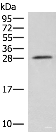 Western blot analysis of Mouse brain tissue lysate  using NIPSNAP3A Polyclonal Antibody at dilution of 1:550