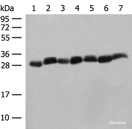 Western blot analysis of Hela cell Mouse spleen tissue Mouse liver tissue PC3 cell HL60 cell A549 cell NIH/3T3 cell lysates  using PSMA3 Polyclonal Antibody at dilution of 1:350