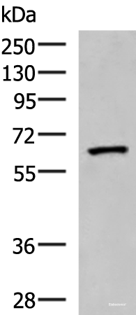 Western blot analysis of Human placenta tissue lysate  using PDIA5 Polyclonal Antibody at dilution of 1:1000