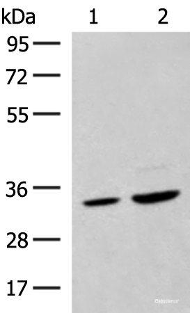 Western blot analysis of Hela cell and Human fetal liver tissue lysates  using SCGN Polyclonal Antibody at dilution of 1:600
