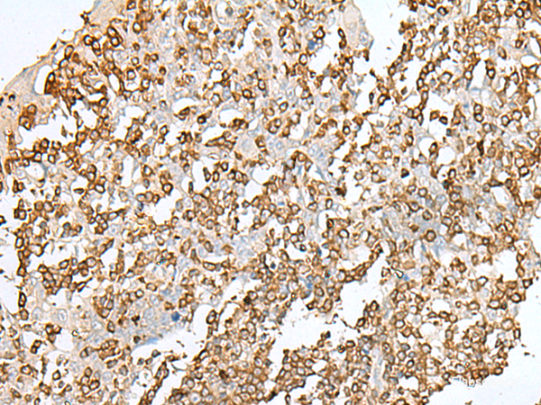 Immunohistochemistry of paraffin-embedded Human tonsil tissue  using SEPT1 Polyclonal Antibody at dilution of 1:50(×200)