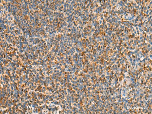 Immunohistochemistry of paraffin-embedded Human tonsil tissue  using STK32C Polyclonal Antibody at dilution of 1:40(×200)