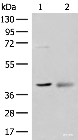 Western blot analysis of Mouse kidney tissue and Human fetal brain tissue lysates  using ADH5 Polyclonal Antibody at dilution of 1:500