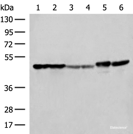 Western blot analysis of Hela A375 Human fetal liver tissue Human fetal brain tissue HepG2 cell and Mouse brain tissue lysates  using FLOT2 Polyclonal Antibody at dilution of 1:350