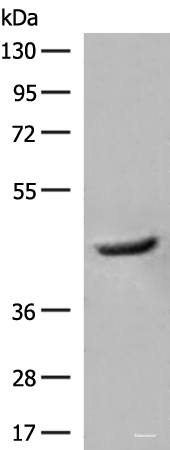 Western blot analysis of Human fetal liver tissue lysate  using GCAT Polyclonal Antibody at dilution of 1:400