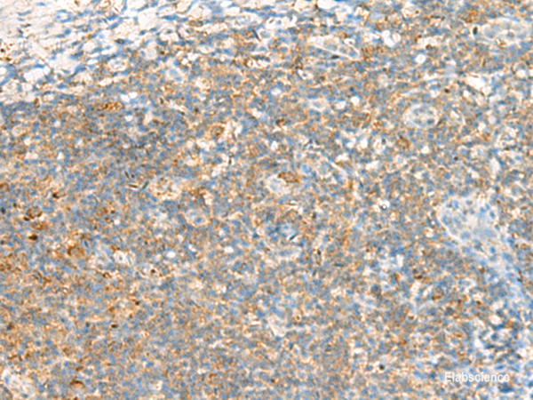 Immunohistochemistry of paraffin-embedded Human tonsil tissue  using TTLL1 Polyclonal Antibody at dilution of 1:60(×200)