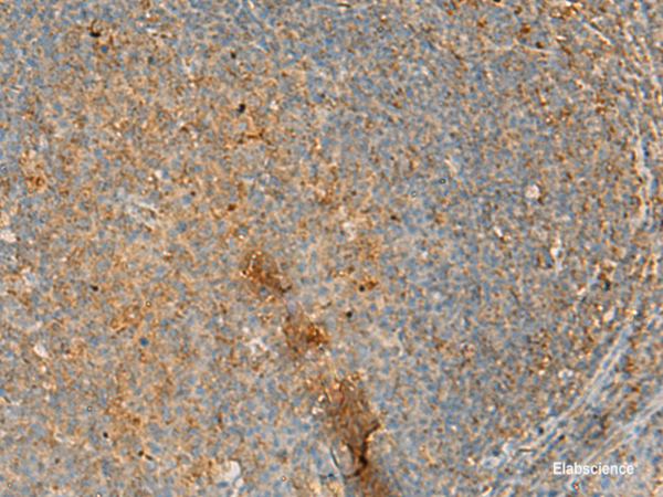 Immunohistochemistry of paraffin-embedded Human tonsil tissue  using ERAL1 Polyclonal Antibody at dilution of 1:50(×200)