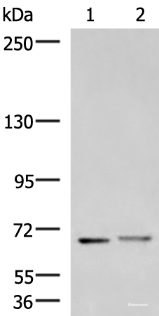 Western blot analysis of Mouse brain tissue and Human cerebrum tissue lysates  using EXD2 Polyclonal Antibody at dilution of 1:700