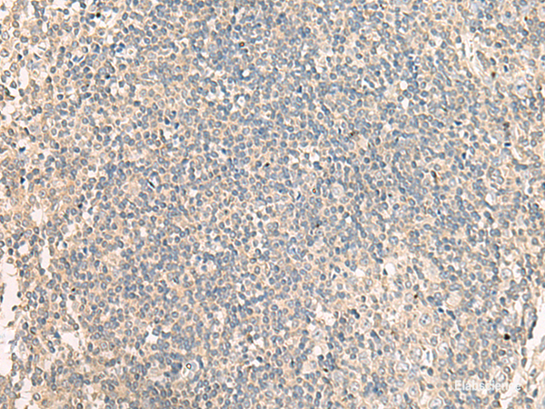 Immunohistochemistry of paraffin-embedded Human tonsil tissue  using NRBP1 Polyclonal Antibody at dilution of 1:60(×200)