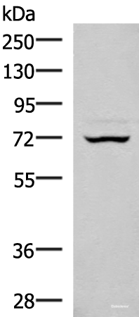 Western blot analysis of 293T cell lysate  using EIF2AK1 Polyclonal Antibody at dilution of 1:350