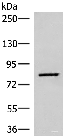 Western blot analysis of Human hepatocellular carcinoma tissue lysate  using SLC26A3 Polyclonal Antibody at dilution of 1:250