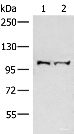 Western blot analysis of Mouse brain tissue and Jurkat cell lysates  using EFTUD2 Polyclonal Antibody at dilution of 1:550