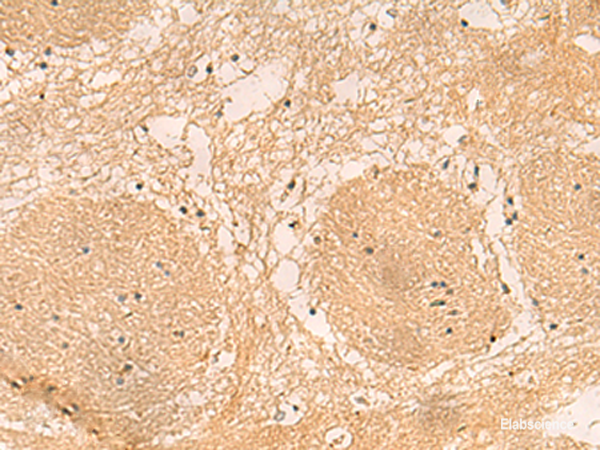 Immunohistochemistry of paraffin-embedded Human brain tissue  using EMC1 Polyclonal Antibody at dilution of 1:40(×200)