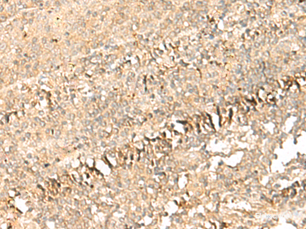 Immunohistochemistry of paraffin-embedded Human tonsil tissue  using PSD4 Polyclonal Antibody at dilution of 1:50(×200)