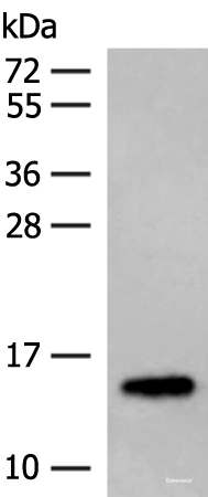 Western blot analysis of Mouse adipose tissue lysates  using LYRM1 Polyclonal Antibody at dilution of 1:300