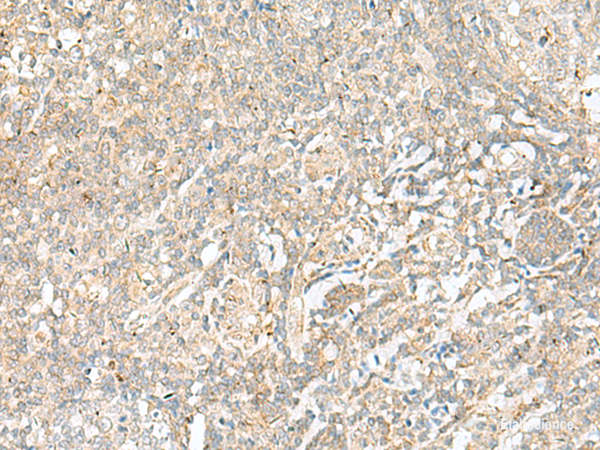 Immunohistochemistry of paraffin-embedded Human tonsil tissue  using BEX2 Polyclonal Antibody at dilution of 1:45(×200)