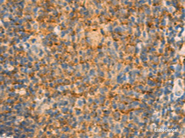 Immunohistochemistry of paraffin-embedded Human tonsil tissue  using IFITM2 Polyclonal Antibody at dilution of 1:25(×200)