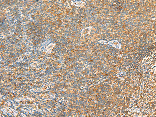 Immunohistochemistry of paraffin-embedded Human tonsil tissue  using MTHFD2L Polyclonal Antibody at dilution of 1:30(×200)