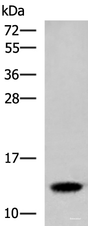 Western blot analysis of Human placenta tissue lysate  using HBE1 Polyclonal Antibody at dilution of 1:300