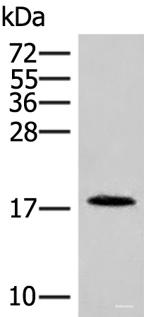 Western blot analysis of Human spleen tissue lysate  using NHP2 Polyclonal Antibody at dilution of 1:400