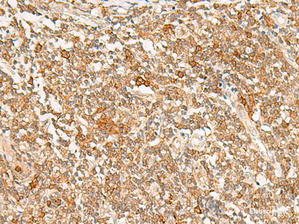 Immunohistochemistry of paraffin-embedded Human tonsil tissue  using JPT1 Polyclonal Antibody at dilution of 1:35(×200)