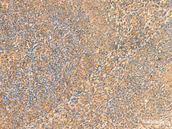 Immunohistochemistry of paraffin-embedded Human tonsil tissue  using UBD Polyclonal Antibody at dilution of 1:50(×200)