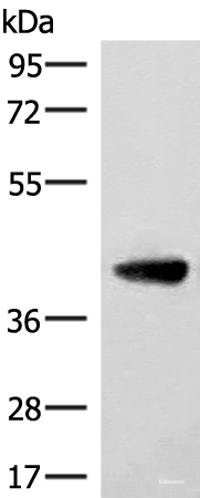 Western blot analysis of Human cerebella tissue lysate  using ST8SIA4 Polyclonal Antibody at dilution of 1:350