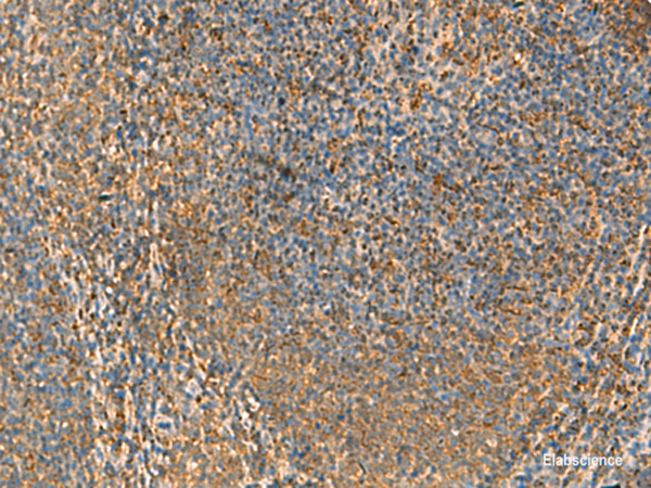 Immunohistochemistry of paraffin-embedded Human tonsil tissue  using PPP1R1A Polyclonal Antibody at dilution of 1:50(×200)