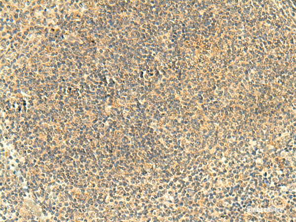 Immunohistochemistry of paraffin-embedded Human tonsil tissue  using FMNL2 Polyclonal Antibody at dilution of 1:50(×200)
