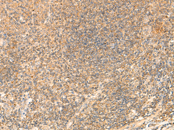 Immunohistochemistry of paraffin-embedded Human tonsil tissue  using PDAP1 Polyclonal Antibody at dilution of 1:50(×200)
