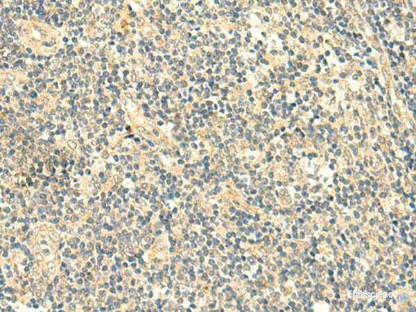 Immunohistochemistry of paraffin-embedded Human tonsil tissue  using TMEM9 Polyclonal Antibody at dilution of 1:50(×200)