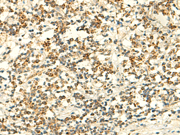 Immunohistochemistry of paraffin-embedded Human tonsil tissue  using IFT27 Polyclonal Antibody at dilution of 1:50(×200)