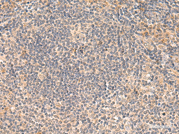 Immunohistochemistry of paraffin-embedded Human tonsil tissue  using FUNDC2 Polyclonal Antibody at dilution of 1:50(×200)