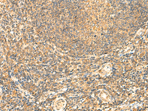 Immunohistochemistry of paraffin-embedded Human tonsil tissue  using LYZL1 Polyclonal Antibody at dilution of 1:50(×200)