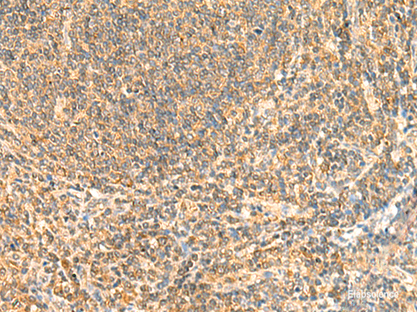 Immunohistochemistry of paraffin-embedded Human tonsil tissue  using ZNF581 Polyclonal Antibody at dilution of 1:50(×200)