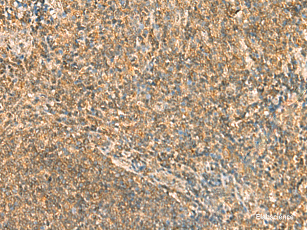 Immunohistochemistry of paraffin-embedded Human tonsil tissue  using SSSCA1 Polyclonal Antibody at dilution of 1:50(×200)