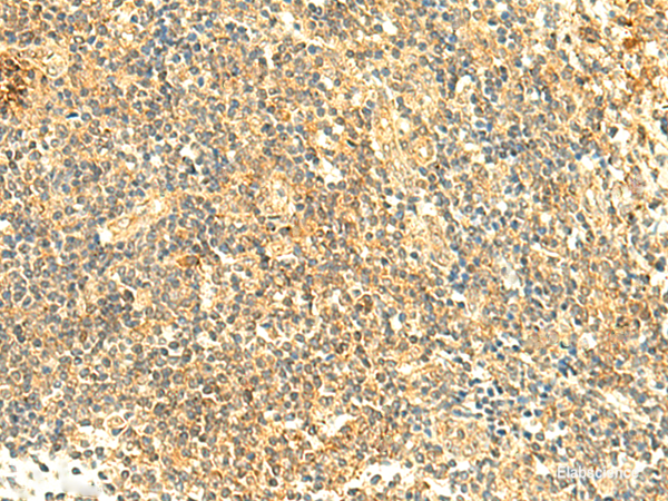 Immunohistochemistry of paraffin-embedded Human tonsil tissue  using ARL4D Polyclonal Antibody at dilution of 1:50(×200)